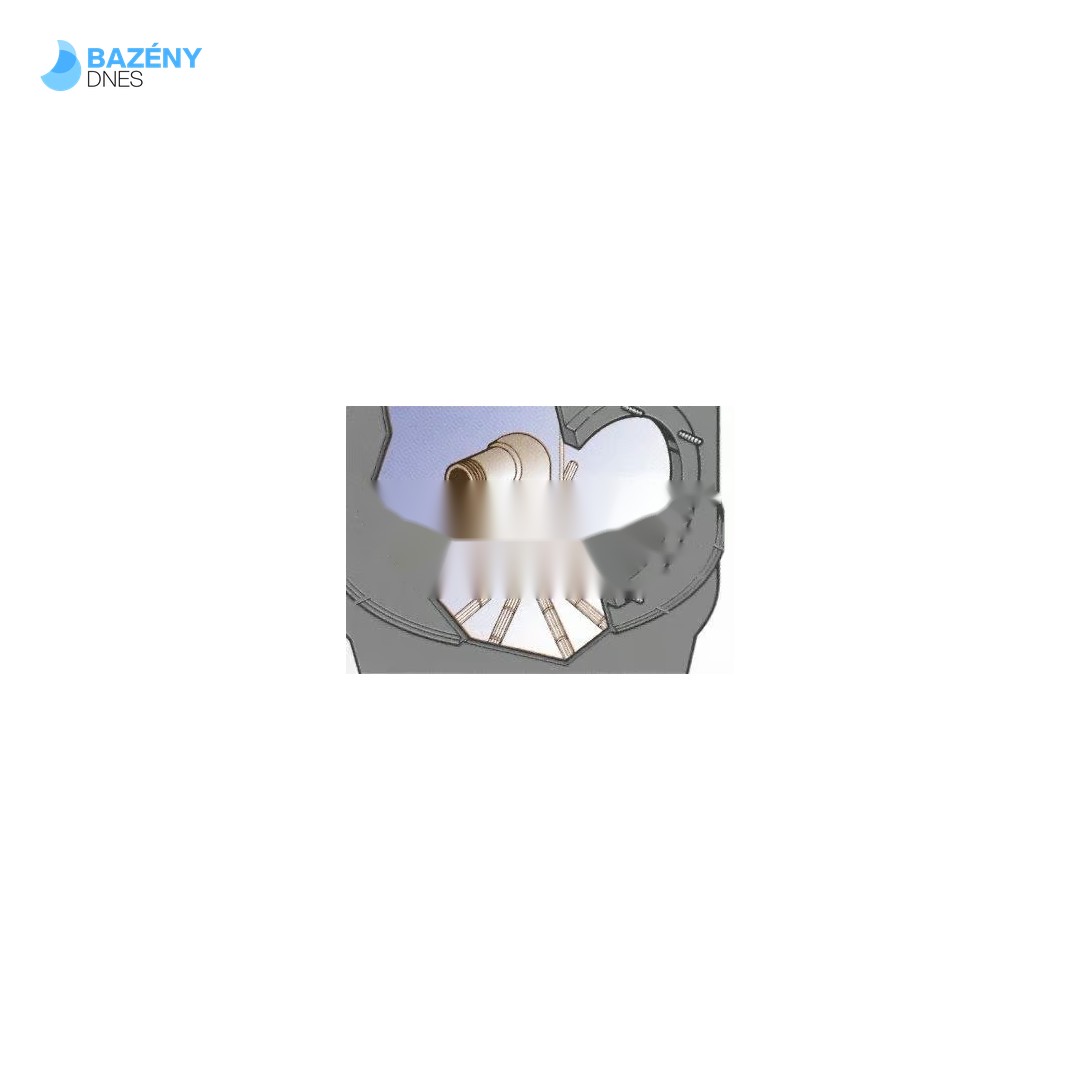 Filtrační nádoba Altea 1200mm - hloubkovrstvá s filtračním křížem (hl. písk. lože 1, 0 m)